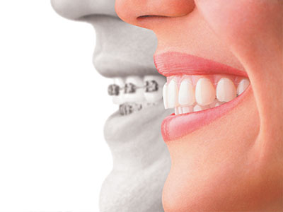 Clark Family Dentistry | Periodontal Treatment, Teeth Whitening and CEREC